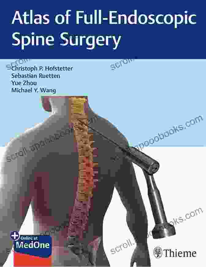 Atlas Of Full Endoscopic Spine Surgery Book Cover Atlas Of Full Endoscopic Spine Surgery