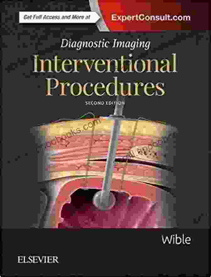 Diagnostic Imaging Interventional Procedures Book Cover Diagnostic Imaging: Interventional Procedures Brandt C Wible