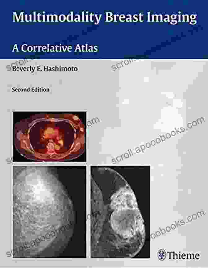 Multimodality Breast Imaging Correlative Atlas Book Cover Multimodality Breast Imaging: A Correlative Atlas