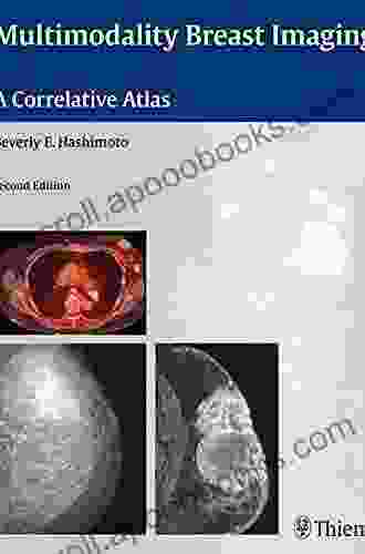 Multimodality Breast Imaging: A Correlative Atlas